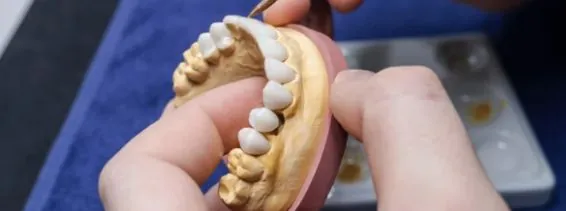 What Are Dental Crowns and How Do They Work?